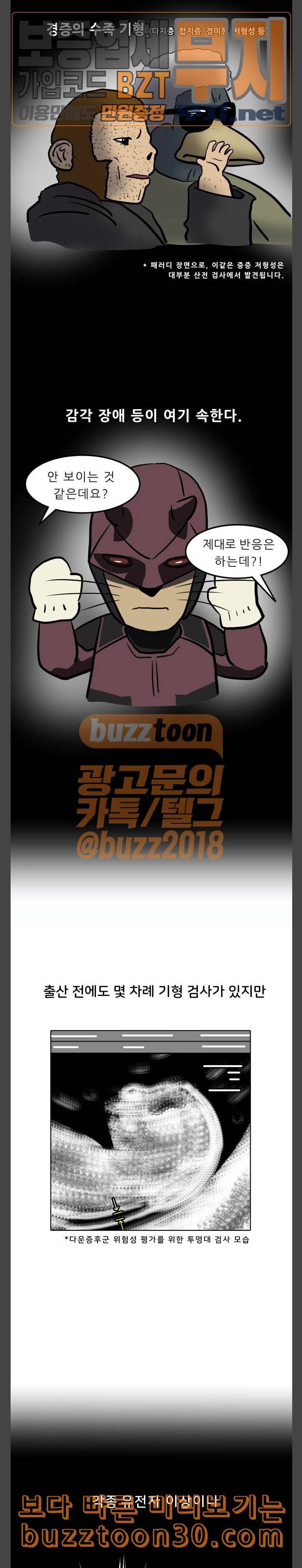 닥터앤닥터 육아일기 40 기형 검사 2